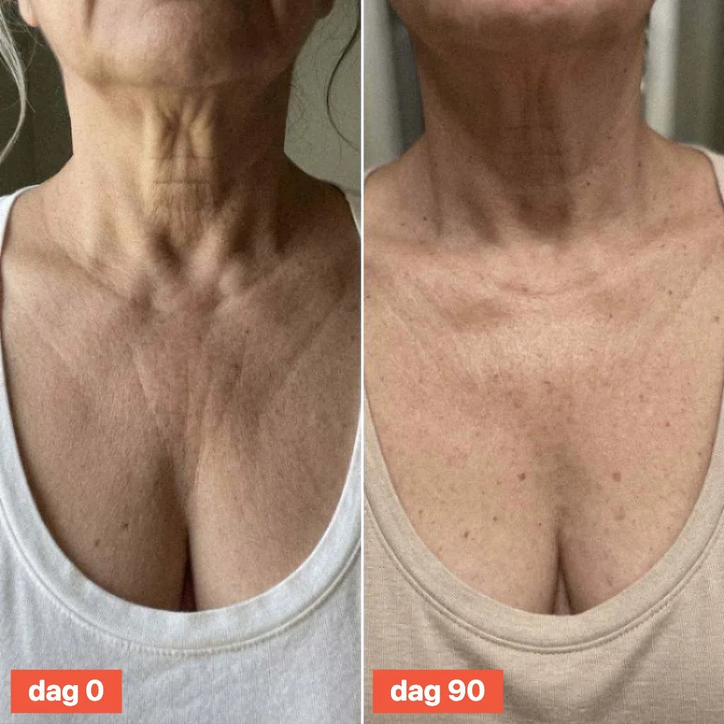 Close-up of a woman's neck and decolletage on day 0 and day 90.