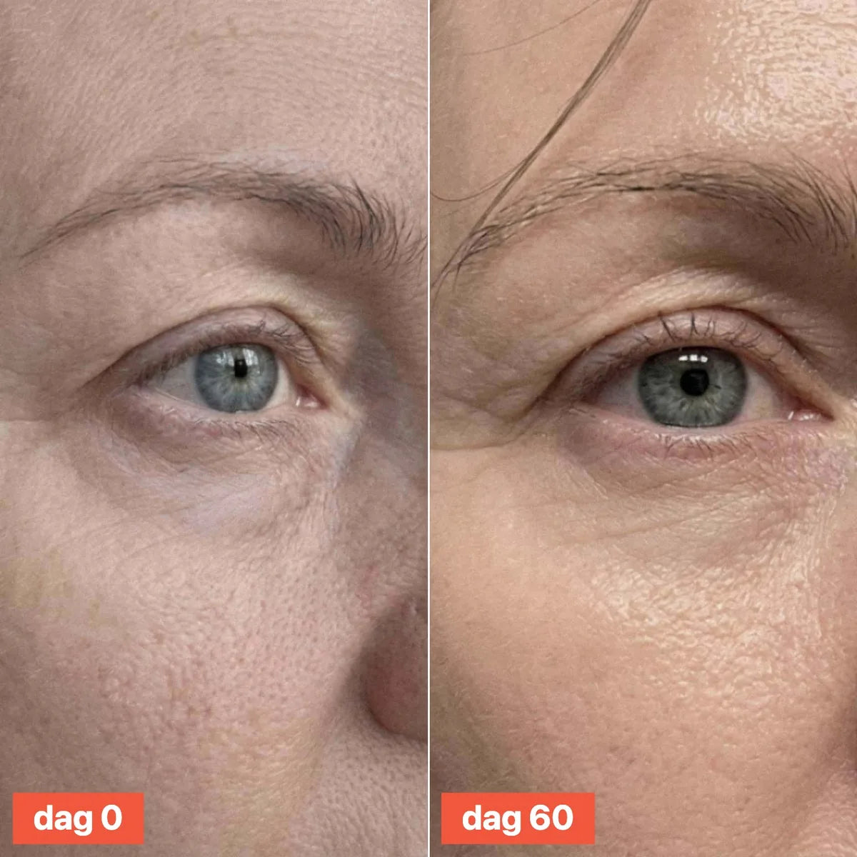 Close-up of the eye area on day 0 and day 60.