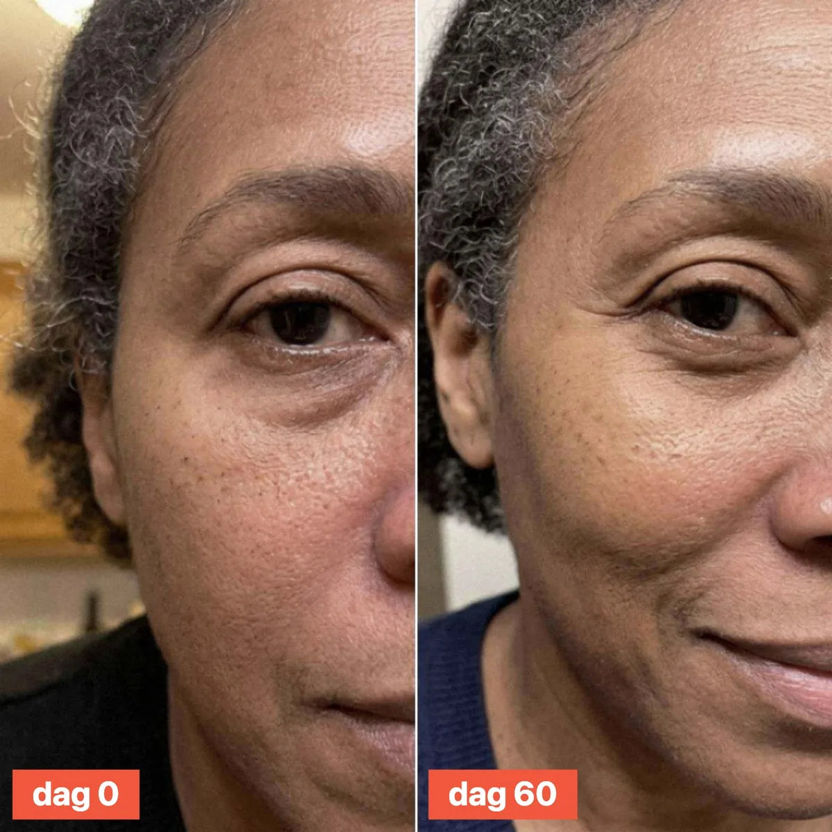 Close-up of the eye area on day 0 and day 60.
